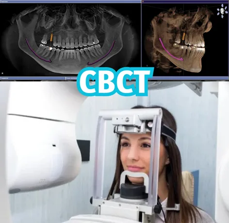 CBCT چیست؟